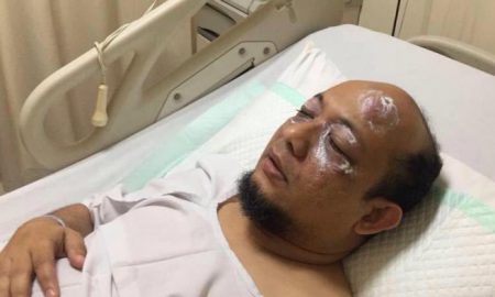 Ketua DPR Desak Aparat Tindak Tegas Penyiram Novel Baswedan