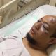 Ketua DPR Desak Aparat Tindak Tegas Penyiram Novel Baswedan Ketua DPR Desak Aparat Tindak Tegas Penyiram Novel Baswedan